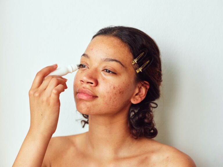 From Breakouts to Recovery: How Treatments Support Teen Skin Concerns