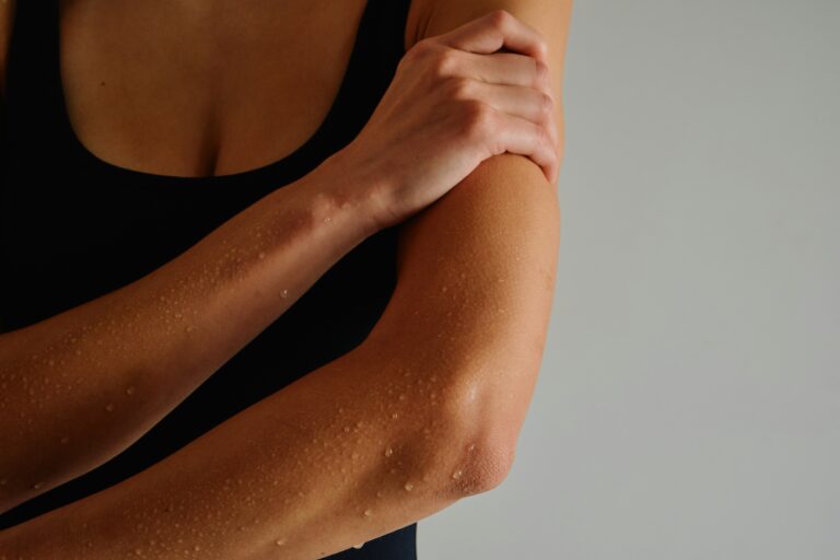 How to Find the Best Treatment for Hyperhidrosis That Truly Works